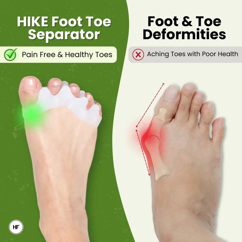 HIKE Foot Toe Separator – For Daily Comfort, Soft Toe Support & Suitable for Bunions and Hammer Toes